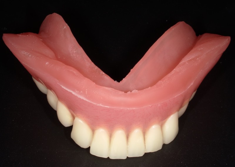 クッション性義歯（１）.jpg