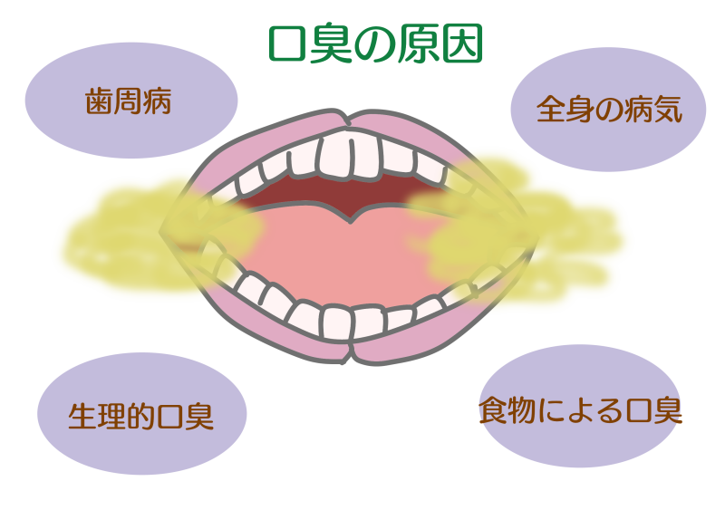口臭　画像.png